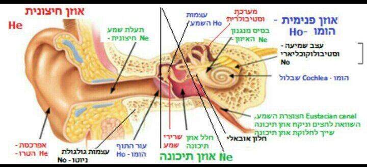 היפראקוזיס